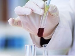 Turkish-German Couple Scientists Are Behind Pfizer/BioNTech Coronavirus Vaccine