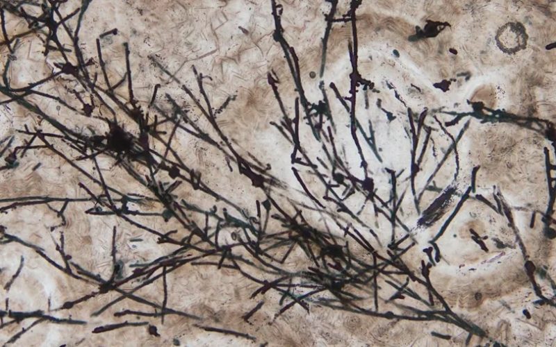 Scientists Unearth 635-Million-Year-Old Fungi Fossil That Contributed to Life Forms on Earth